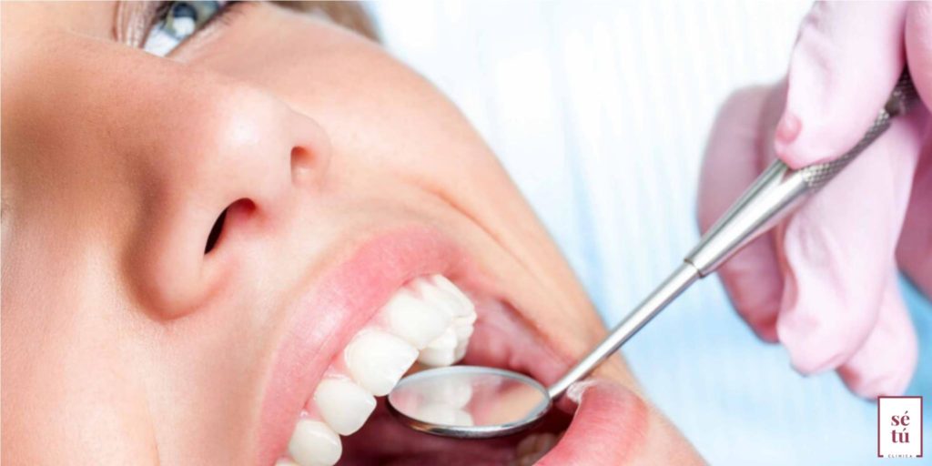carillas_implantes_dentales_se_tu_clinica