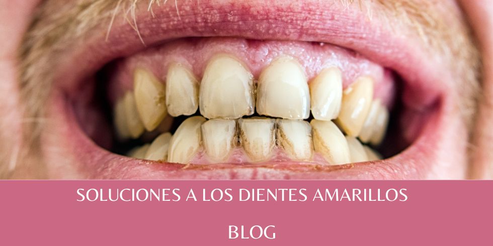 blog dientes amarillos se tu vila-real
