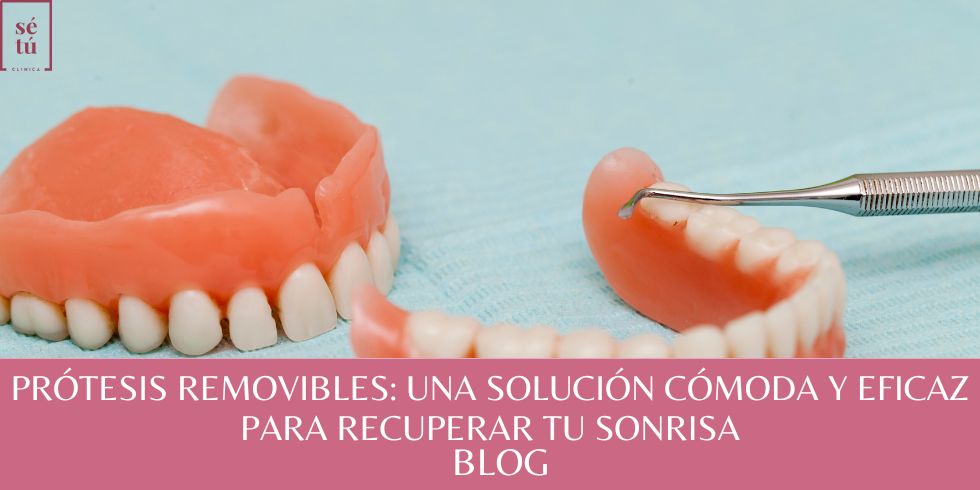 brackets se tuc linica vila-real